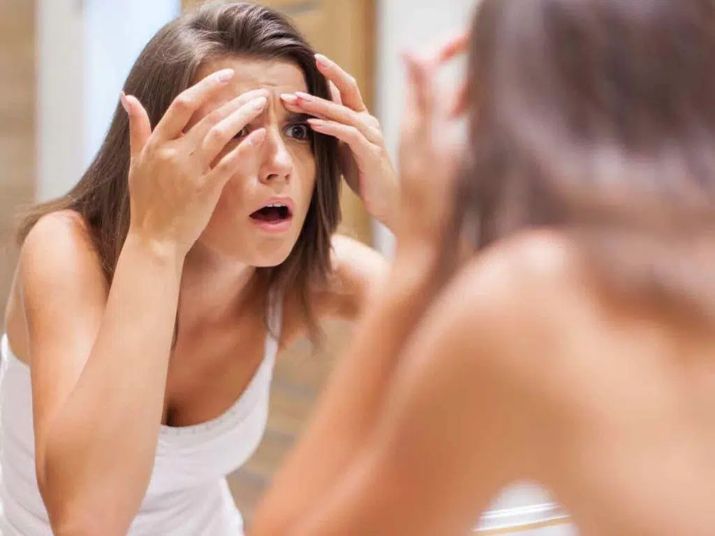 réguler une peau grasse